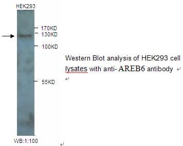 IHC-plus™ ZEB1 / AREB6 Antibody