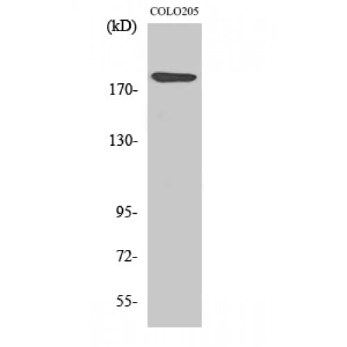 LAMA4 / Laminin Alpha 4 Antibody (450-530 aa, Internal)