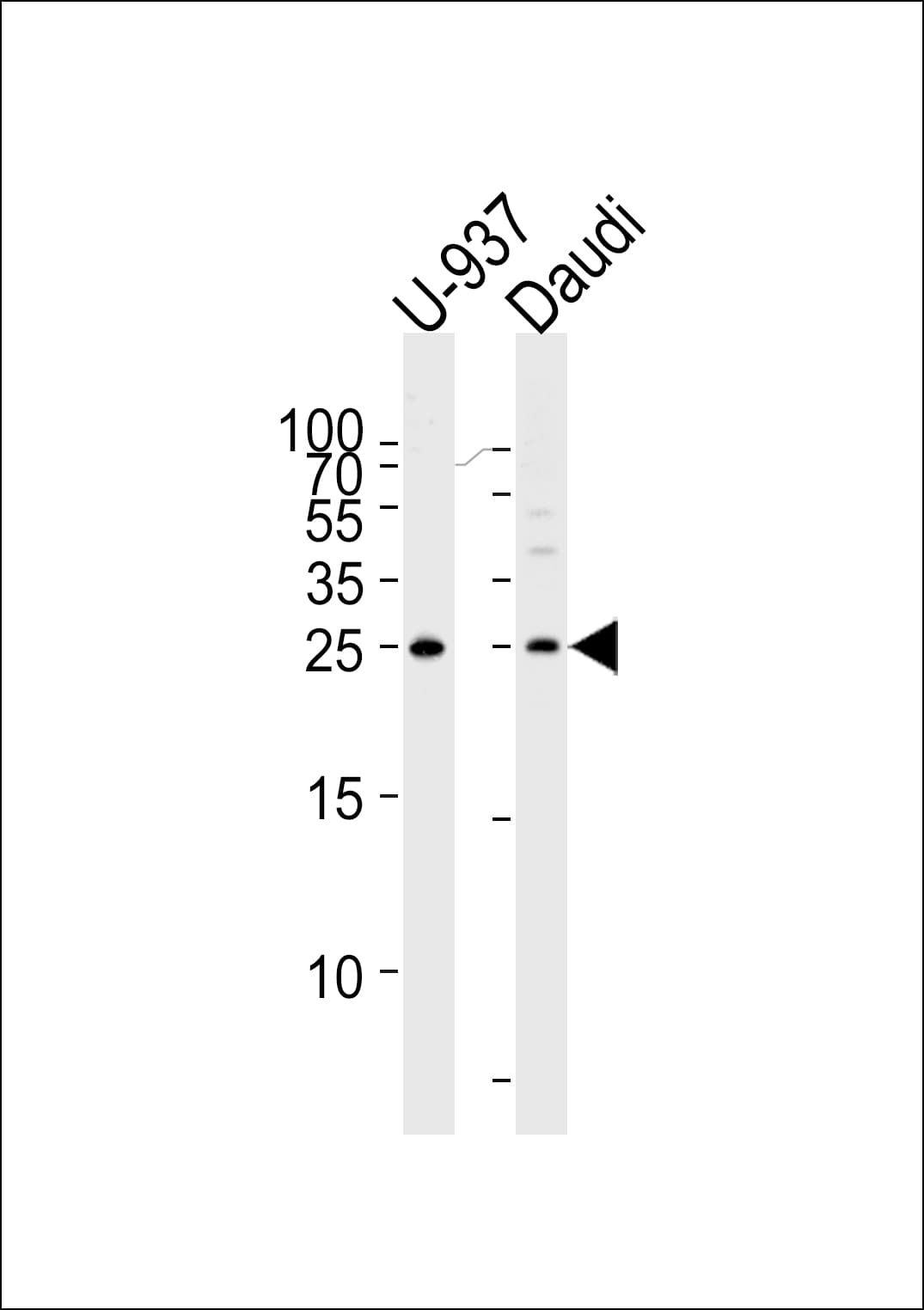 Polyclonal Rabbit anti-Human CD37 Antibody (aa101-130, WB)