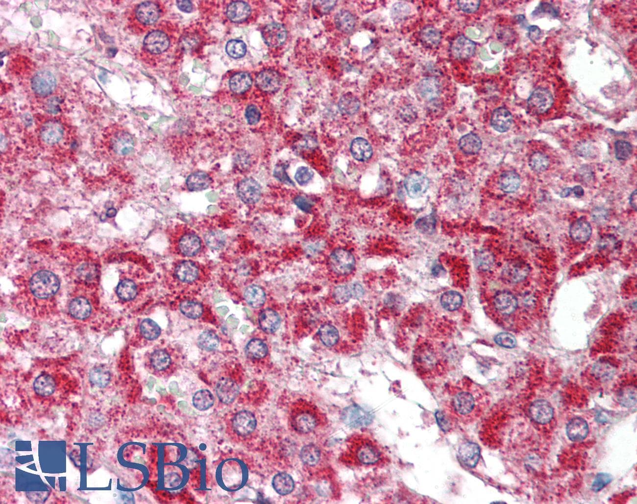 IHC-plus™ Polyclonal Rabbit anti-Human HUS1B Antibody (IHC, WB)