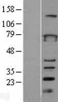ZBTB3 Protein (Over-Expression Lysate Myc-DDK (Flag))