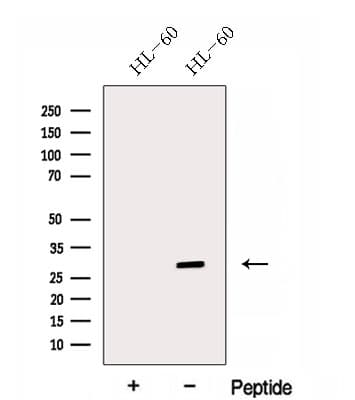 Polyclonal Rabbit anti-Human ENOPH1 / MASA Antibody (WB)