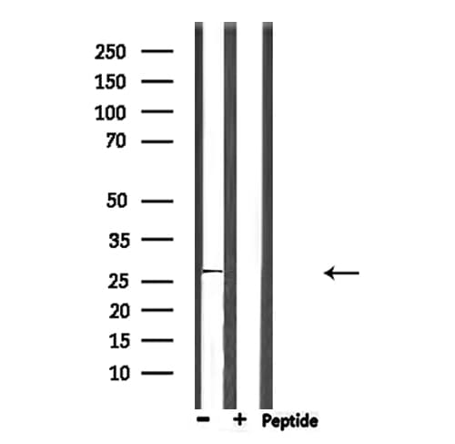 NQO2 Antibody