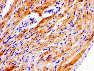 NDRG4 Antibody