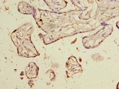 NOL6 / NRAP Antibody