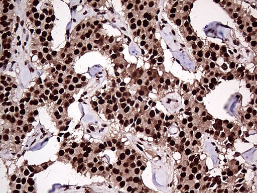 Monoclonal Mouse anti-Human ZRANB2 / ZNF265 Antibody (clone OTI2E3, aa95-320, IHC, WB)