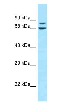 MAGED1 / NRAGE Antibody (aa516-565)
