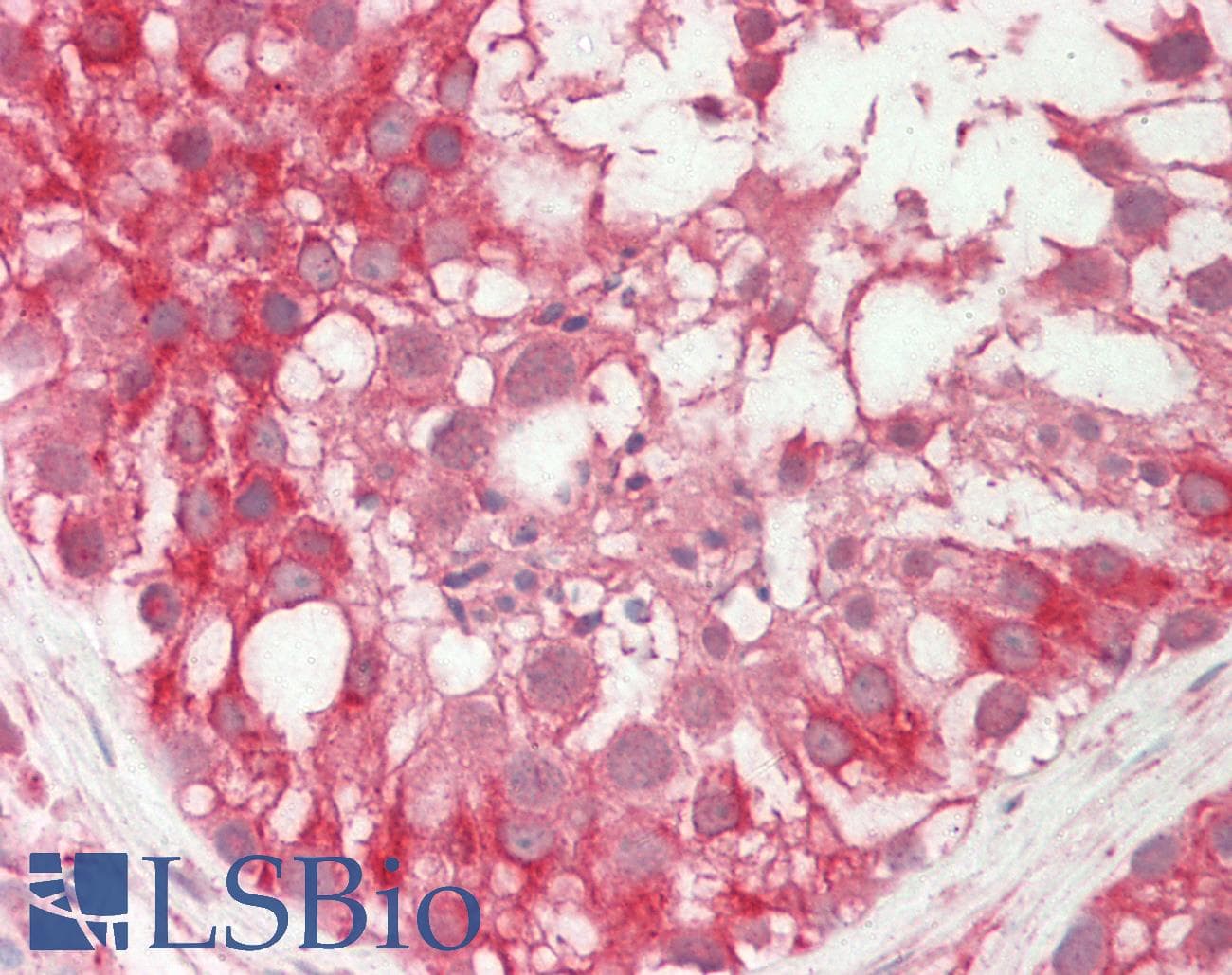 TMPRSS3 Antibody (N-Terminus)