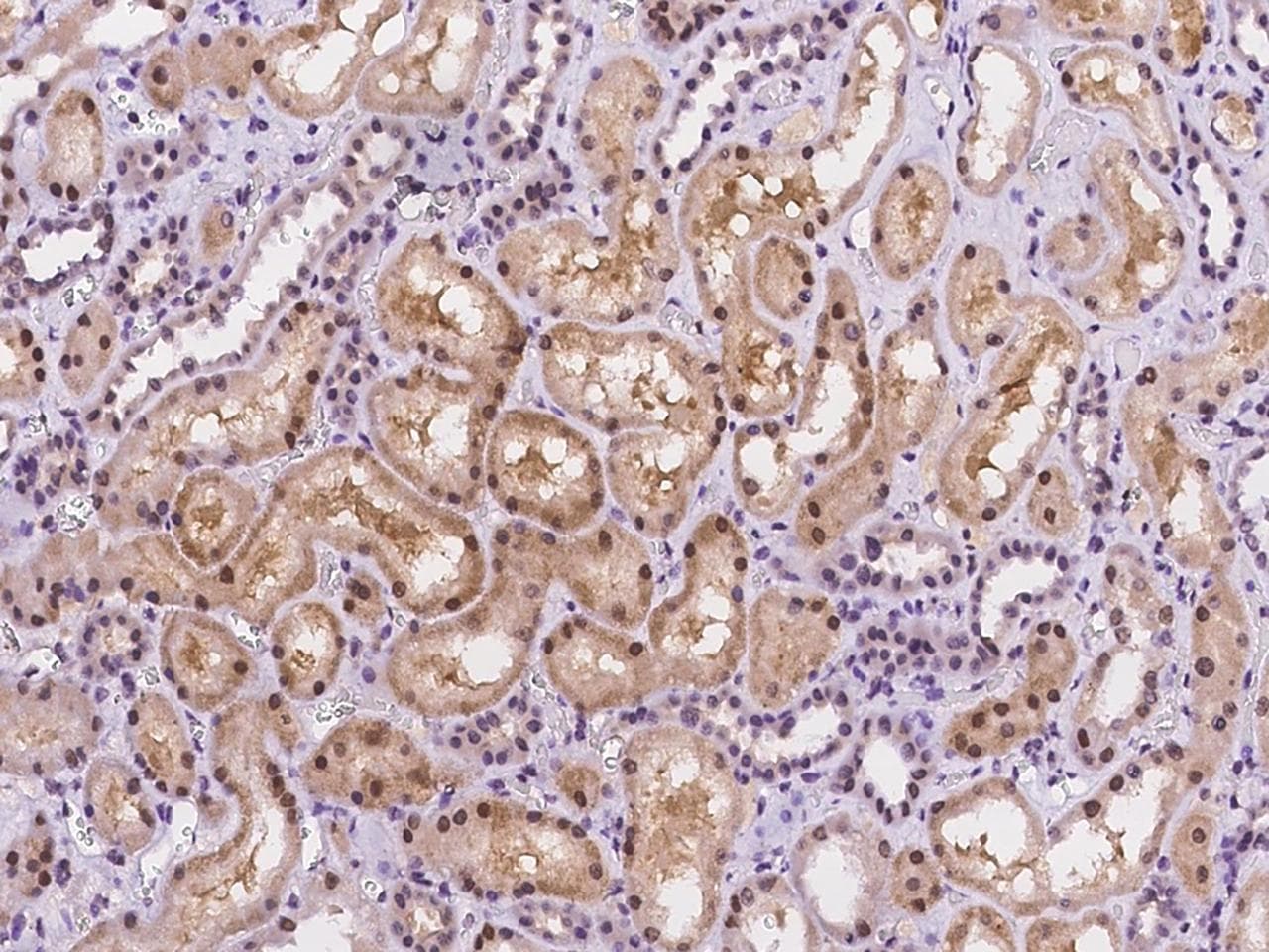 Polyclonal Rabbit anti-Human NACC1 / NAC1 Antibody (IHC)