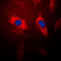 YWHAQ / 14-3-3 Theta Antibody (Internal)