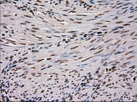 SCYL3 Antibody (clone OTI1A5)