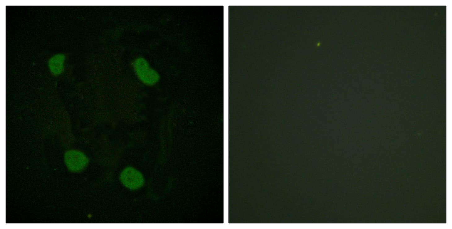 Histone H3 Antibody (Acetyl-Lys14)