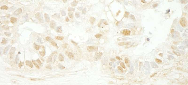 MYBL2 Antibody (aa250-300)