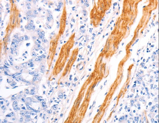 TPM1 / Tropomyosin Antibody