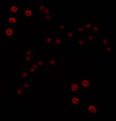 TBX1 Antibody