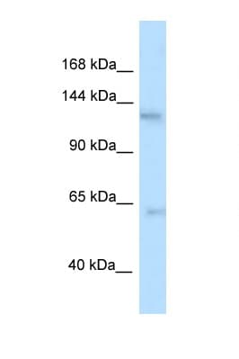 TTBK2 Antibody (aa270-319)