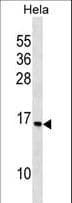 RPS14 / Ribosomal Protein S14 Antibody (aa118-147)