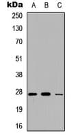 Polyclonal Rabbit anti-Human CFD / Factor D / Adipsin Antibody (N-Terminus, WB)