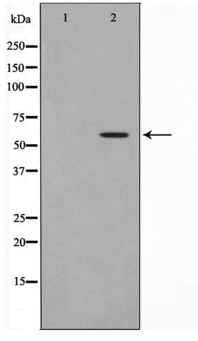 MMP19 Antibody