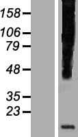 HHLA3 Protein (Over-Expression Lysate Myc-DDK (Flag))