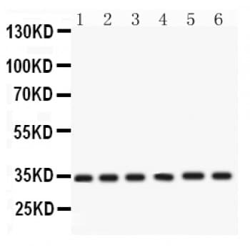 CDK4 Antibody (aa201-303)