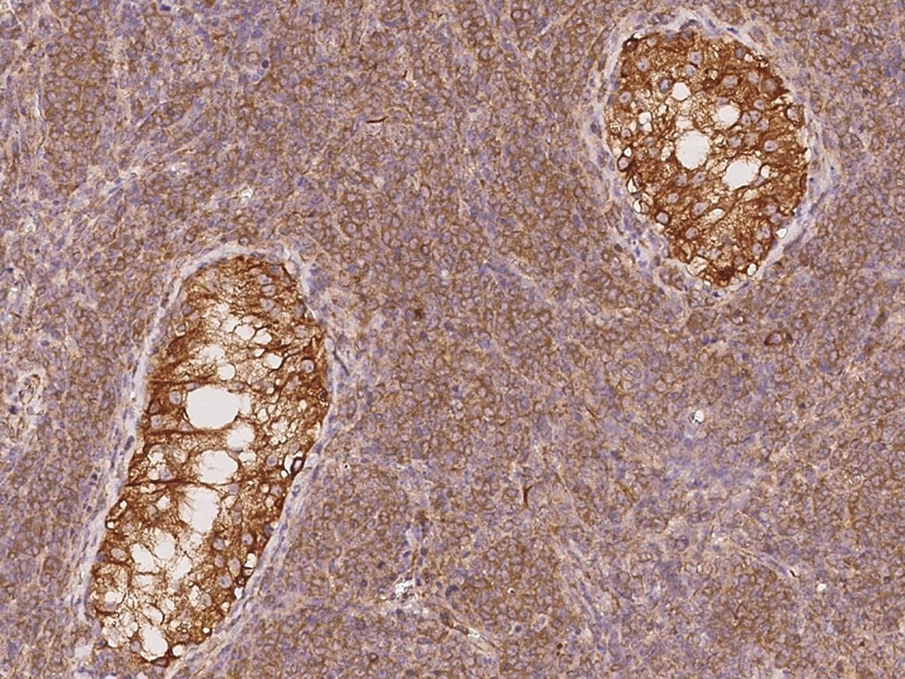 TXNDC2 Antibody
