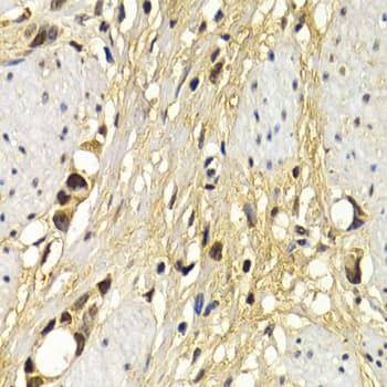 Polyclonal Rabbit anti-Human UAP1 Antibody (IHC, WB)