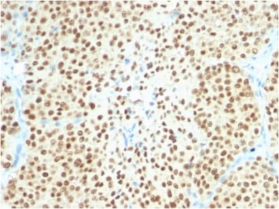 SOX10 Antibody (aa115-269, clone SOX10/2311R)
