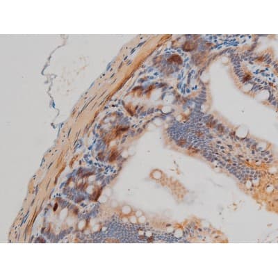 Polyclonal Rabbit anti-Human GFAP Antibody (phospho-Ser38, IHC, IF, WB)