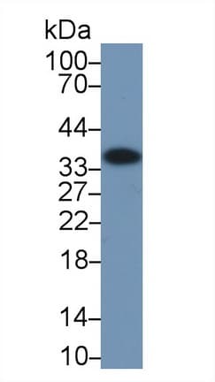 ANXA4 / Annexin IV Antibody (aa165-260)