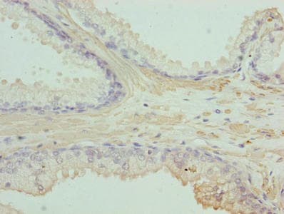 ACTG2 Antibody