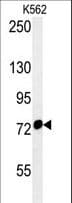 HSPA9 / Mortalin / GRP75 Antibody (aa273-301)