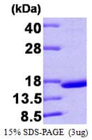 Human TTR / Transthyretin Protein (Recombinant)