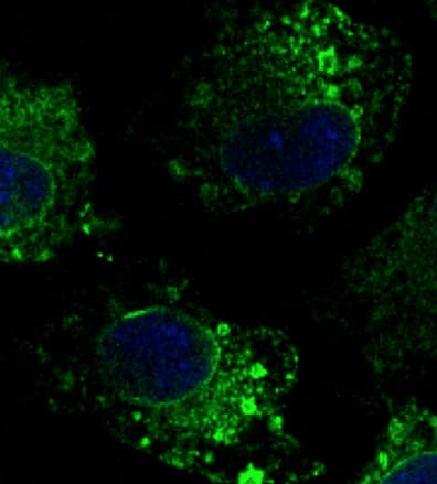 PathPlus™ Polyclonal Goat anti-Human CANX / Calnexin Antibody (C-Terminus, IHC, IF, WB)