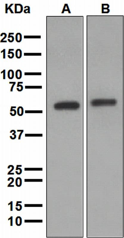 IHC-plus™ ALDH2 Antibody (Internal, clone EPR4493)