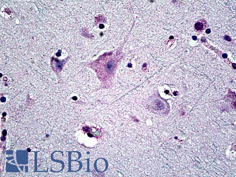 Capicua / CIC Antibody (aa1500-1608, DY650)