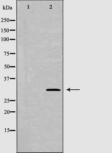 Polyclonal Rabbit anti-Human TPSAB1 / Mast Cell Tryptase Antibody (IHC, IF, WB)