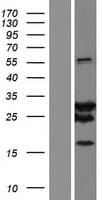 SPAG16 Protein (Over-Expression Lysate Myc-DDK (Flag))