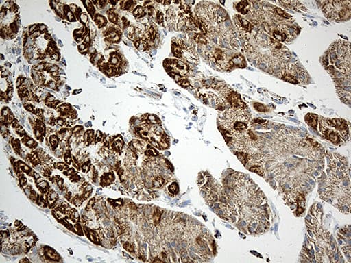 MCAD / ACADM Antibody (clone OTI10A5)