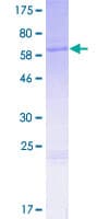 Human WNT6 Protein (Recombinant GST)