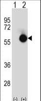 CTBP2 Antibody (aa1-30)