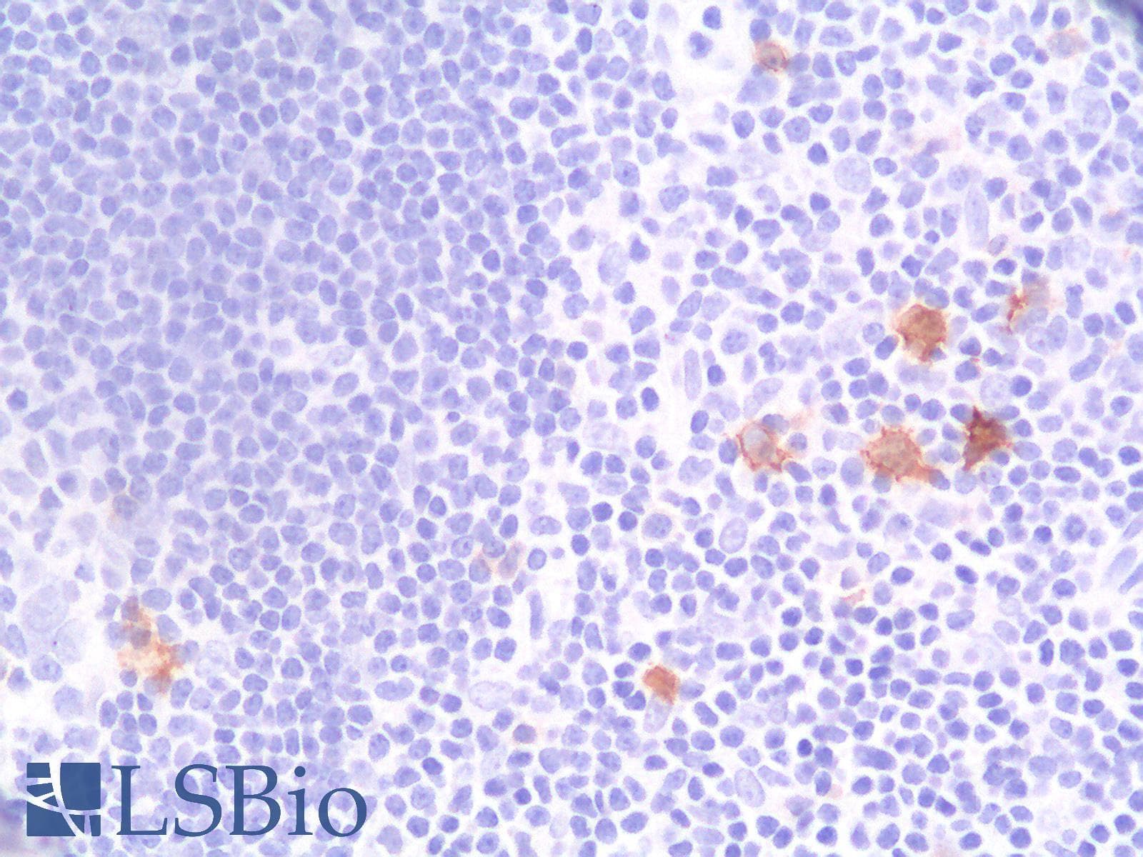 PathPlus™ Recombinant Monoclonal Rabbit anti-Human CD30 Antibody (clone Ki-1/1505R, IHC)