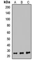 Polyclonal Rabbit anti-Human PSMB6 Antibody (WB)