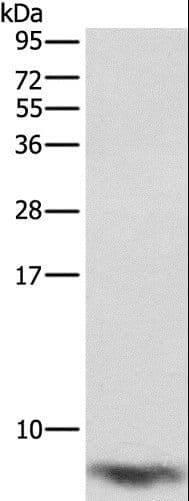 FXYD1 / Phospholemman Antibody