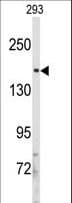 IRS2 / IRS-2 Antibody (aa1309-1338)