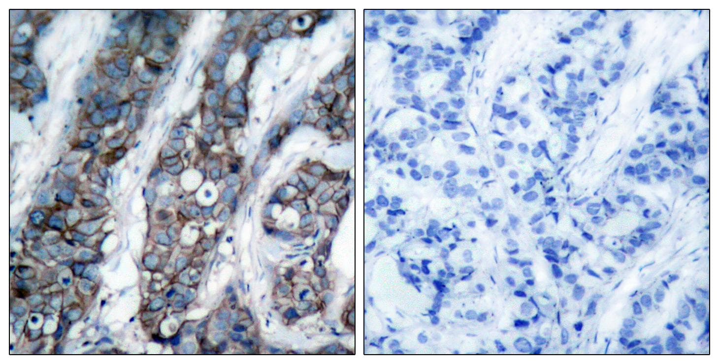 Polyclonal Rabbit anti-Human ERBB2 / HER2 Antibody (phospho-Tyr1248, IHC, WB)