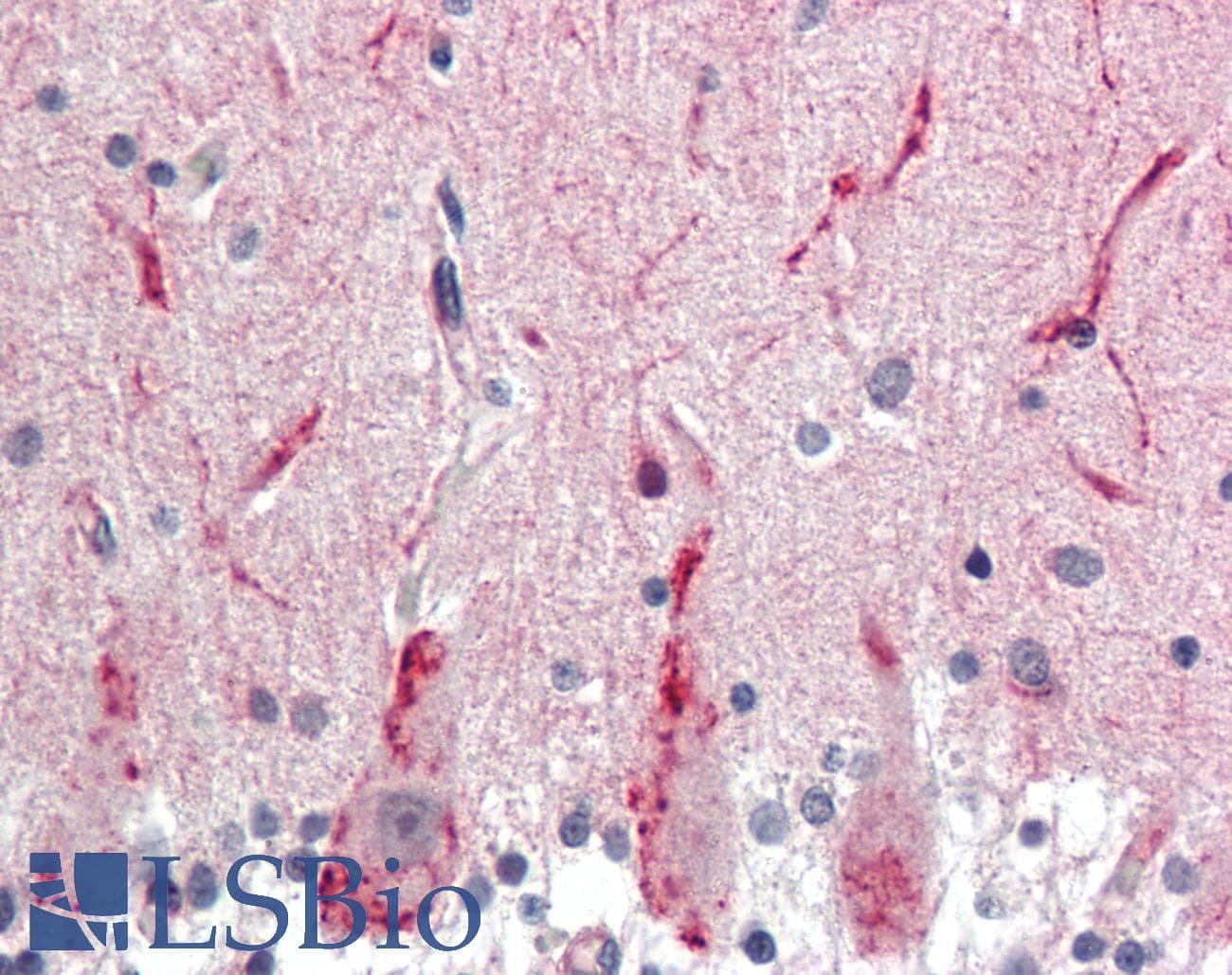GABRG2 Antibody (aa61-110)