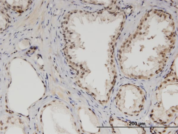 Monoclonal Mouse anti-Human MED6 Antibody (clone 4C2, IHC, WB)