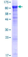 Human BBS2 / BBS Protein (Recombinant GST)