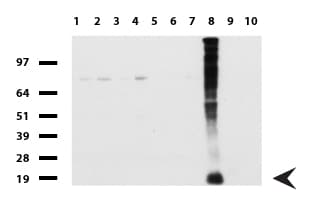 WFDC2 / HE4 Antibody (aa31-124, clone UMAB88)